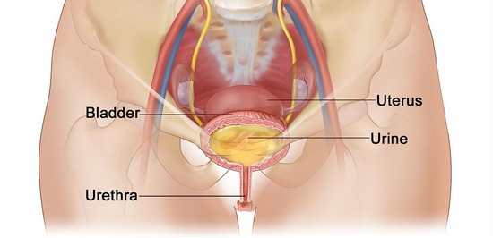 Sténose de l'urètre ·