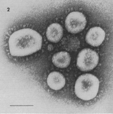 Il était une fois les coronavirus – Réalités Biomédicales