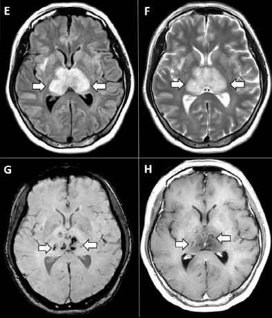 IRM cérébrale – Page 3 – Réalités Biomédicales