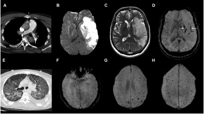 IRM cérébrale – Page 2 – Réalités Biomédicales