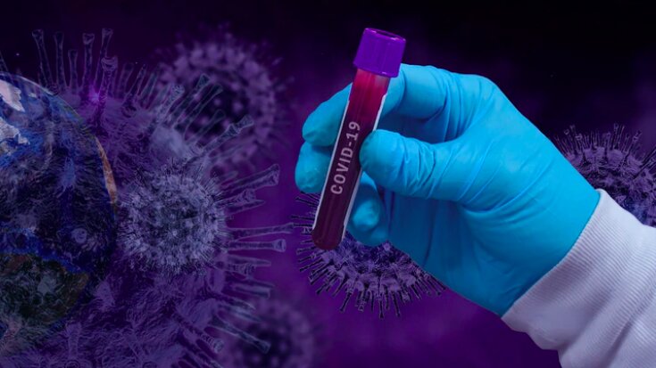 Covid 19 Ce Que Revele L Analyse Du Systeme Immunitaire Dans Les Formes Severes Realites Biomedicales